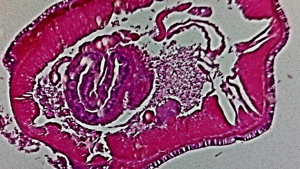 Oligochaeta Cross Section